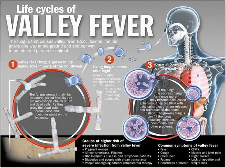 newValley-fever-4.jpg